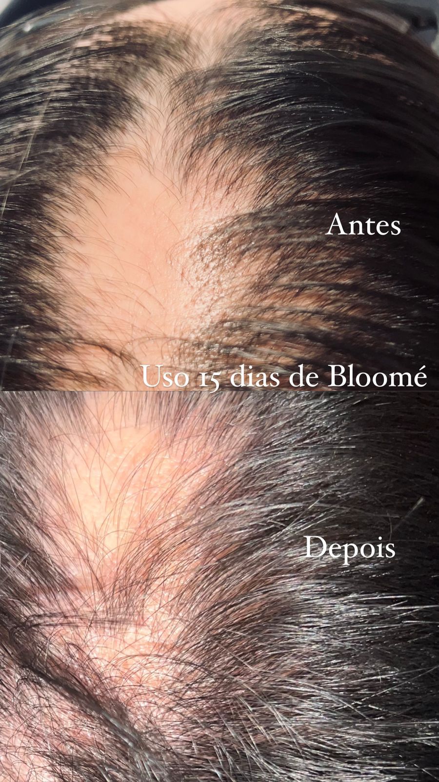 BLOOMÉ — Crescimento Capilar de Forma Natural e Eficaz